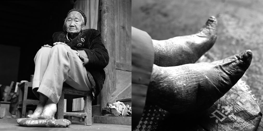 Si Yin Zhin and her Lotus Feet - Source: The Guardian