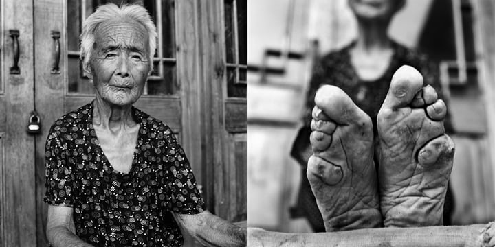 Zao Hua Hong and her Lotus Feet - Source: The Guardian